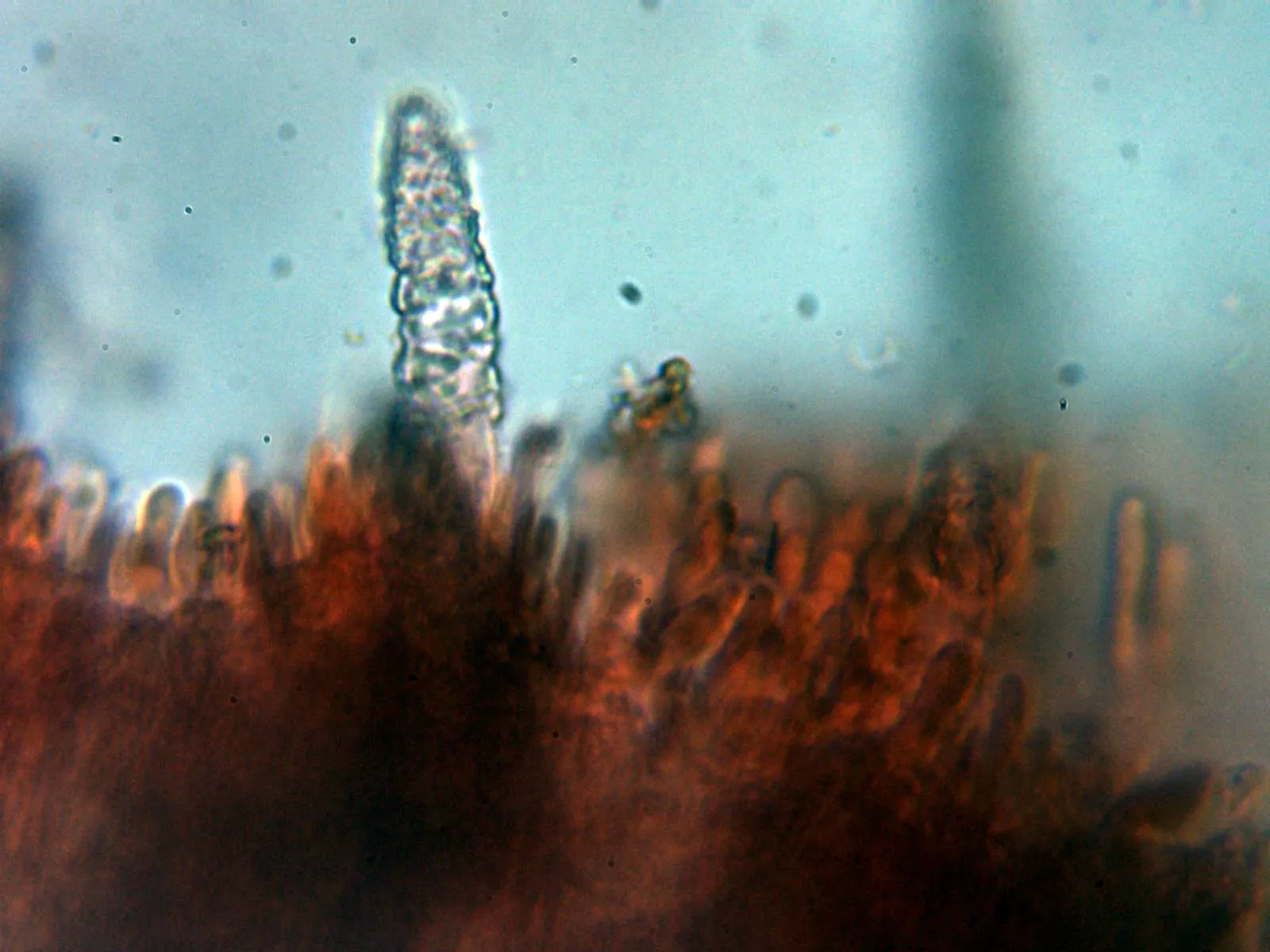 Microscopía de Phlebiopsis gigantea - 10 - Himenio 2